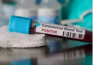 10 إصابات جديدة بفيروس كورونا مع عدم تسجيل أي وفيات خلال 24 سا الأخيرة