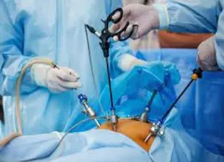 تقنية التنظير الباطني للتكفل بالمرضى ..  200 عملية لعلاج انسداد القنوات الصفراوية والبنكرياس